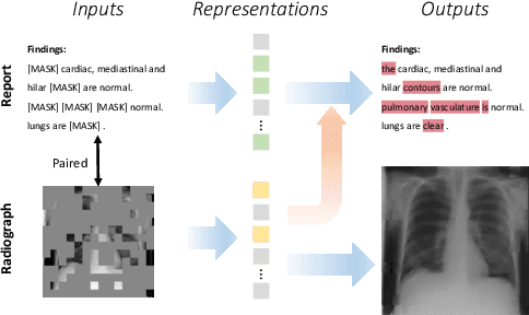 Figure 1 for Advancing Radiograph Representation Learning with Masked Record Modeling