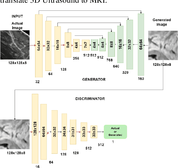 Figure 3 for BrainVoxGen: Deep learning framework for synthesis of Ultrasound to MRI