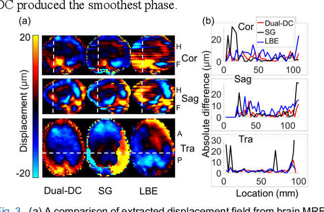 Figure 3 for MR Elastography with Optimization-Based Phase Unwrapping and Traveling Wave Expansion-based Neural Network (TWENN)