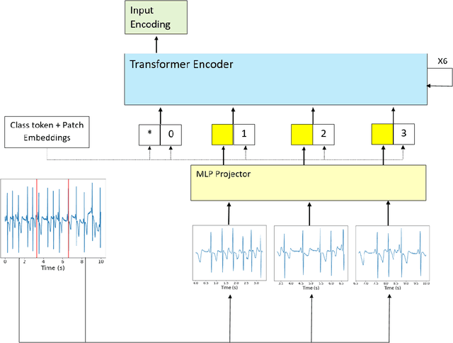 Figure 1 for Subject-based Non-contrastive Self-Supervised Learning for ECG Signal Processing