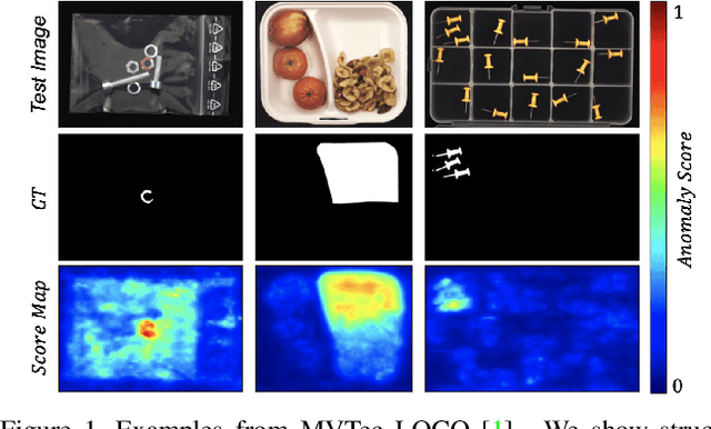 Figure 1 for Contextual Affinity Distillation for Image Anomaly Detection
