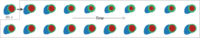 Figure 3 for CHeart: A Conditional Spatio-Temporal Generative Model for Cardiac Anatomy