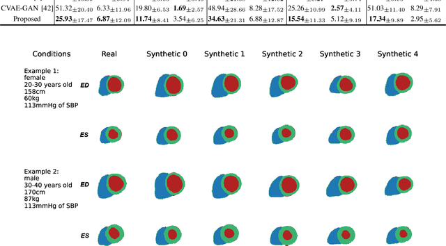 Figure 4 for CHeart: A Conditional Spatio-Temporal Generative Model for Cardiac Anatomy