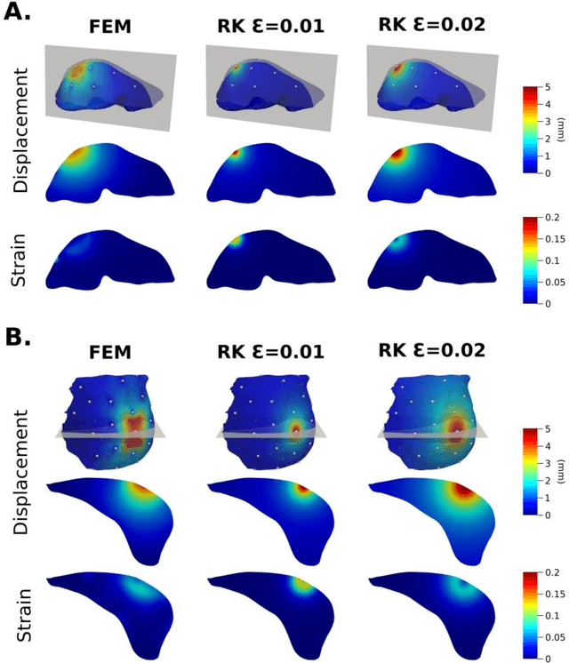 Figure 3 for Comparing Regularized Kelvinlet Functions and the Finite Element Method for Registration of Medical Images to Sparse Organ Data