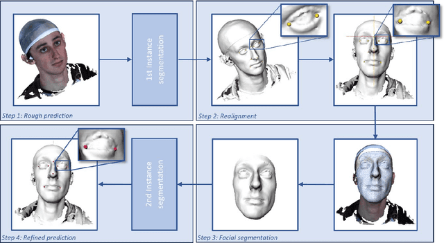Figure 2 for Fully automated landmarking and facial segmentation on 3D photographs