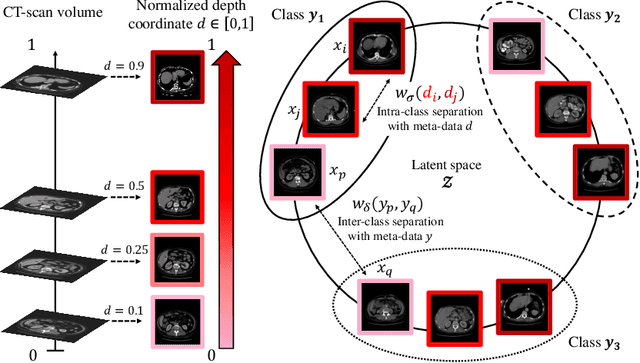 Figure 1 for Weakly-supervised positional contrastive learning: application to cirrhosis classification