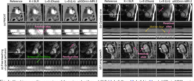 Figure 1 for Fast Low Rank column-wise Compressive Sensing for Accelerated Dynamic MRI