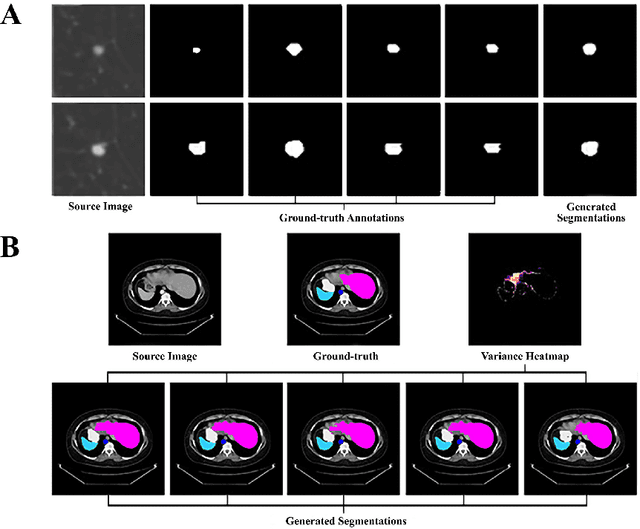 Figure 3 for Hierarchical Uncertainty Estimation for Medical Image Segmentation Networks