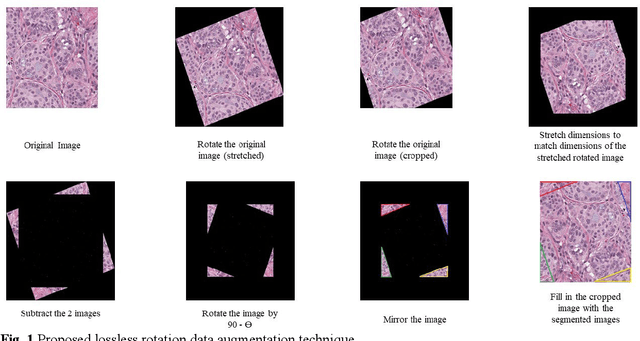 Figure 1 for Combination of multiple neural networks using transfer learning and extensive geometric data augmentation for assessing cellularity scores in histopathology images