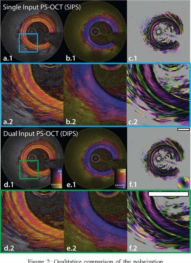 Figure 2 for Single-Input Polarization-Sensitive Optical Coherence Tomography Through a Catheter