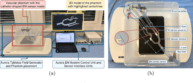 Figure 1 for WarpEM: Dynamic Time Warping for Accurate Catheter Registration in EM-guided Procedures