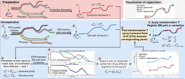 Figure 2 for WarpEM: Dynamic Time Warping for Accurate Catheter Registration in EM-guided Procedures