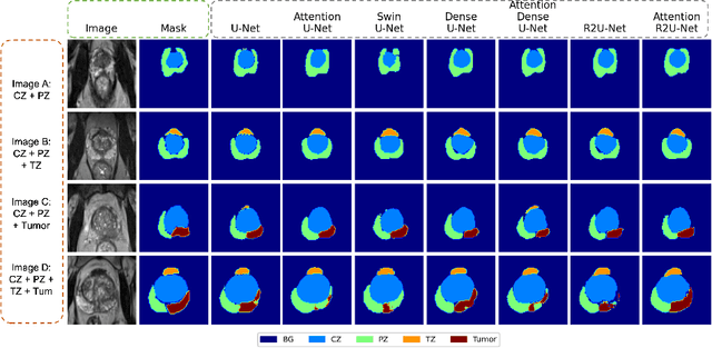 Figure 3 for Assessing the performance of deep learning-based models for prostate cancer segmentation using uncertainty scores
