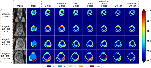 Figure 4 for Assessing the performance of deep learning-based models for prostate cancer segmentation using uncertainty scores