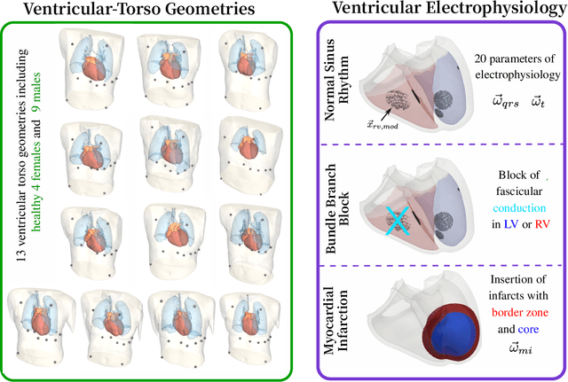 Figure 3 for MedalCare-XL: 16,900 healthy and pathological 12 lead ECGs obtained through electrophysiological simulations