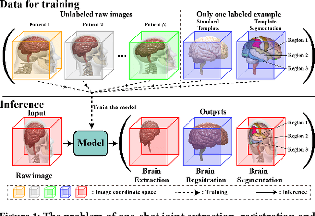 Figure 1 for One-shot Joint Extraction, Registration and Segmentation of Neuroimaging Data