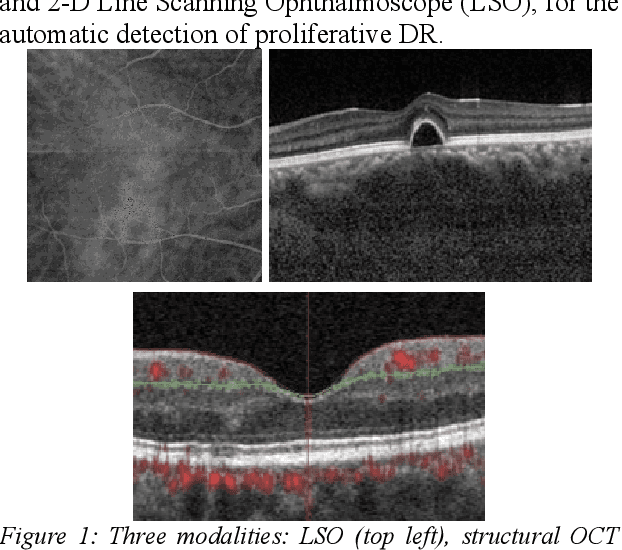 Figure 1 for Multimodal Information Fusion For The Diagnosis Of Diabetic Retinopathy