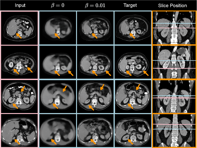 Figure 4 for Deep conditional generative models for longitudinal single-slice abdominal computed tomography harmonization