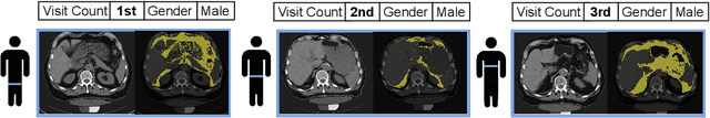 Figure 1 for Deep conditional generative models for longitudinal single-slice abdominal computed tomography harmonization