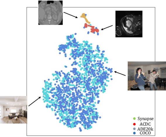 Figure 1 for How to Efficiently Adapt Large Segmentation Model(SAM) to Medical Images