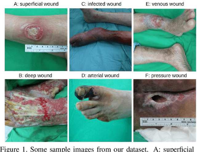 Figure 1 for Development of a deep learning-based tool to assist wound classification