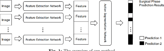 Figure 1 for SF-TMN: SlowFast Temporal Modeling Network for Surgical Phase Recognition