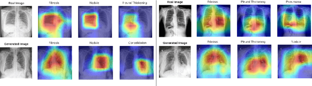 Figure 4 for Cyclic Generative Adversarial Networks With Congruent Image-Report Generation For Explainable Medical Image Analysis