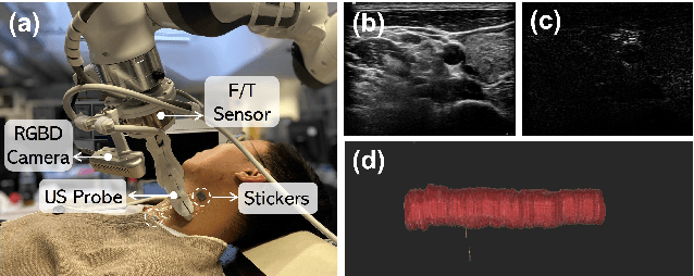 Figure 1 for Motion Magnification in Robotic Sonography: Enabling Pulsation-Aware Artery Segmentation