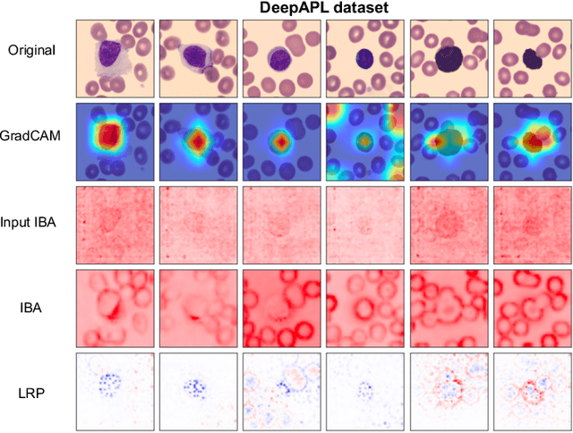 Figure 4 for Pixel-Level Explanation of Multiple Instance Learning Models in Biomedical Single Cell Images