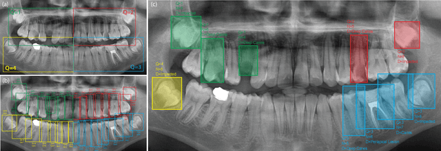 Figure 1 for DENTEX: An Abnormal Tooth Detection with Dental Enumeration and Diagnosis Benchmark for Panoramic X-rays