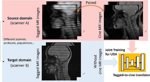 Figure 1 for Attentive Continuous Generative Self-training for Unsupervised Domain Adaptive Medical Image Translation
