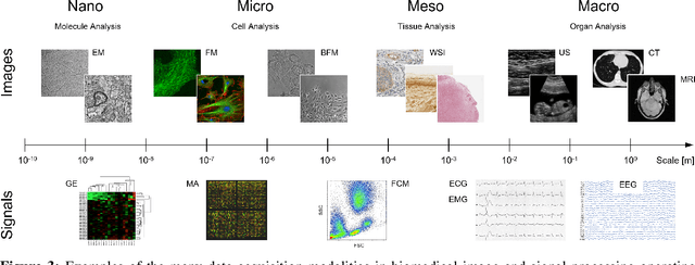 Figure 3 for From Nano to Macro: Overview of the IEEE Bio Image and Signal Processing Technical Committee