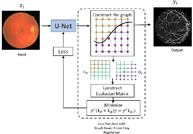 Figure 1 for Pixel Relationships-based Regularizer for Retinal Vessel Image Segmentation