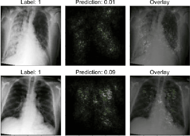 Figure 3 for Predicting Ejection Fraction from Chest X-rays Using Computer Vision for Diagnosing Heart Failure