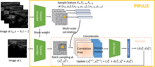 Figure 1 for PIPsUS: Self-Supervised Dense Point Tracking in Ultrasound