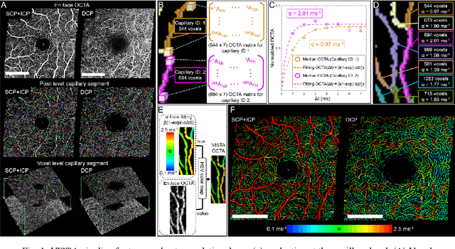 Figure 2 for Retinal blood flow speed quantification at the capillary level using temporal autocorrelation fitting OCTA