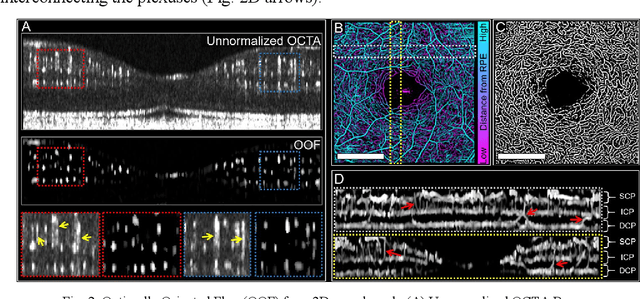 Figure 3 for Retinal blood flow speed quantification at the capillary level using temporal autocorrelation fitting OCTA