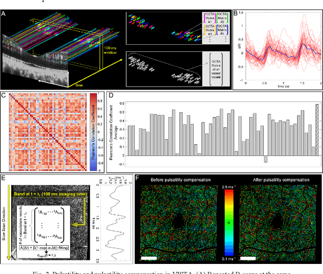 Figure 4 for Retinal blood flow speed quantification at the capillary level using temporal autocorrelation fitting OCTA