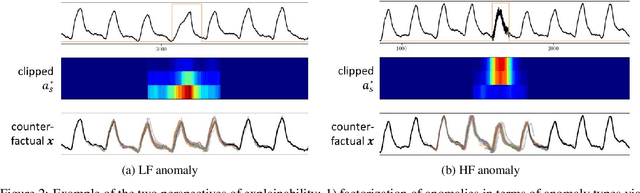 Figure 3 for Explainable Anomaly Detection using Masked Latent Generative Modeling