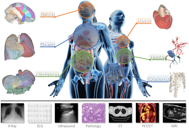 Figure 2 for On the Challenges and Perspectives of Foundation Models for Medical Image Analysis