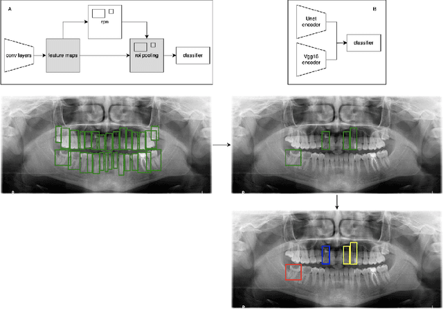 Figure 1 for A Sequential Framework for Detection and Classification of Abnormal Teeth in Panoramic X-rays