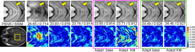 Figure 4 for Generalizing Supervised Deep Learning MRI Reconstruction to Multiple and Unseen Contrasts using Meta-Learning Hypernetworks