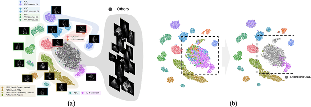 Figure 1 for Echocardiographic View Classification with Integrated Out-of-Distribution Detection for Enhanced Automatic Echocardiographic Analysis