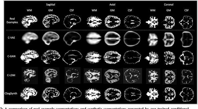 Figure 2 for Deep Generative Model-Based Generation of Synthetic Individual-Specific Brain MRI Segmentations