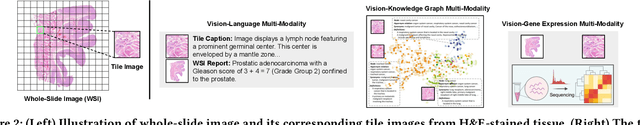 Figure 3 for Multi-Modal Foundation Models for Computational Pathology: A Survey