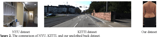 Figure 2 for A Dual-Feature Extractor Framework for Accurate Back Depth and Spine Morphology Estimation from Monocular RGB Images