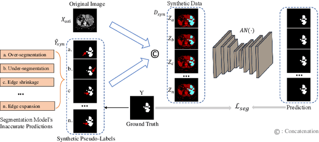Figure 3 for ASLseg: Adapting SAM in the Loop for Semi-supervised Liver Tumor Segmentation