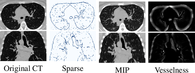 Figure 3 for Few-Shot Airway-Tree Modeling using Data-Driven Sparse Priors