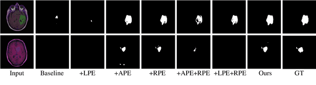 Figure 3 for Parameter-Efficient Transformer with Hybrid Axial-Attention for Medical Image Segmentation