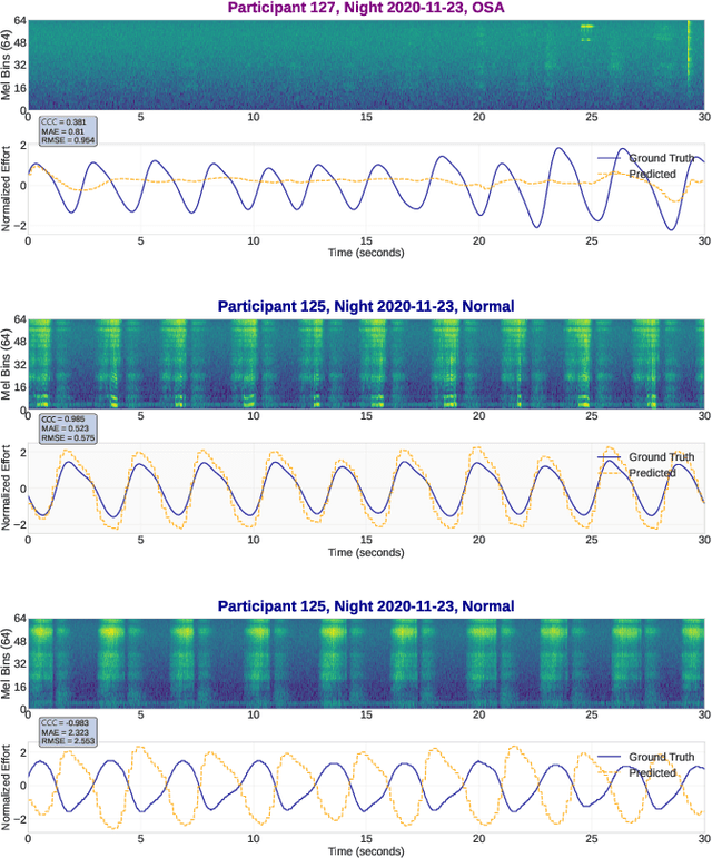 Figure 4 for Estimating Respiratory Effort from Nocturnal Breathing Sounds for Obstructive Sleep Apnoea Screening